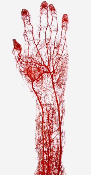 Gunther von Hagens, acid-corrosion cast of the arteries of the adult human hand